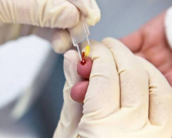 Avropa ölkələrində hər il viruslu hepatitlərdən 170 min insan həyatını itirir