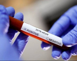 Belarusda koronavirusa yoluxanların sayı 1486 nəfərə çatıb, 16 nəfər ölüb