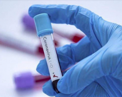 Agentlik: 25 və 26 iyul koronavirus testinin nəticələri haqqında göndərilən məlumatda yanlışlıq olub
