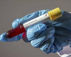 Azərbaycanda 112 nəfər koronavirusa yoluxdu, 178 nəfər sağaldı
