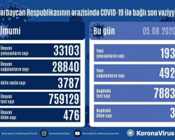Azərbaycanda daha 193 nəfər koronavirusa yoluxdu, 492 nəfər sağaldı, 3 nəfər öldü
