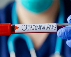 Azərbaycanda koronavirusdan daha 1891 nəfər sağalıb, 334 yeni yoluxma faktı qeydə alınıb