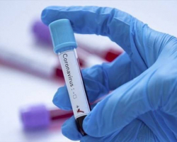 Daha üç azərbaycanlıda koronavirus aşkarlandı