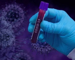 Son sutkada dünyada 5 mindən çox insan koronavirusdan həyatını itirib