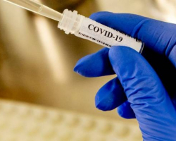 Bu gündən Azərbaycanda koronavirusa qarşı vaksinin ikinci dozasının vurulmasına başlanılıb